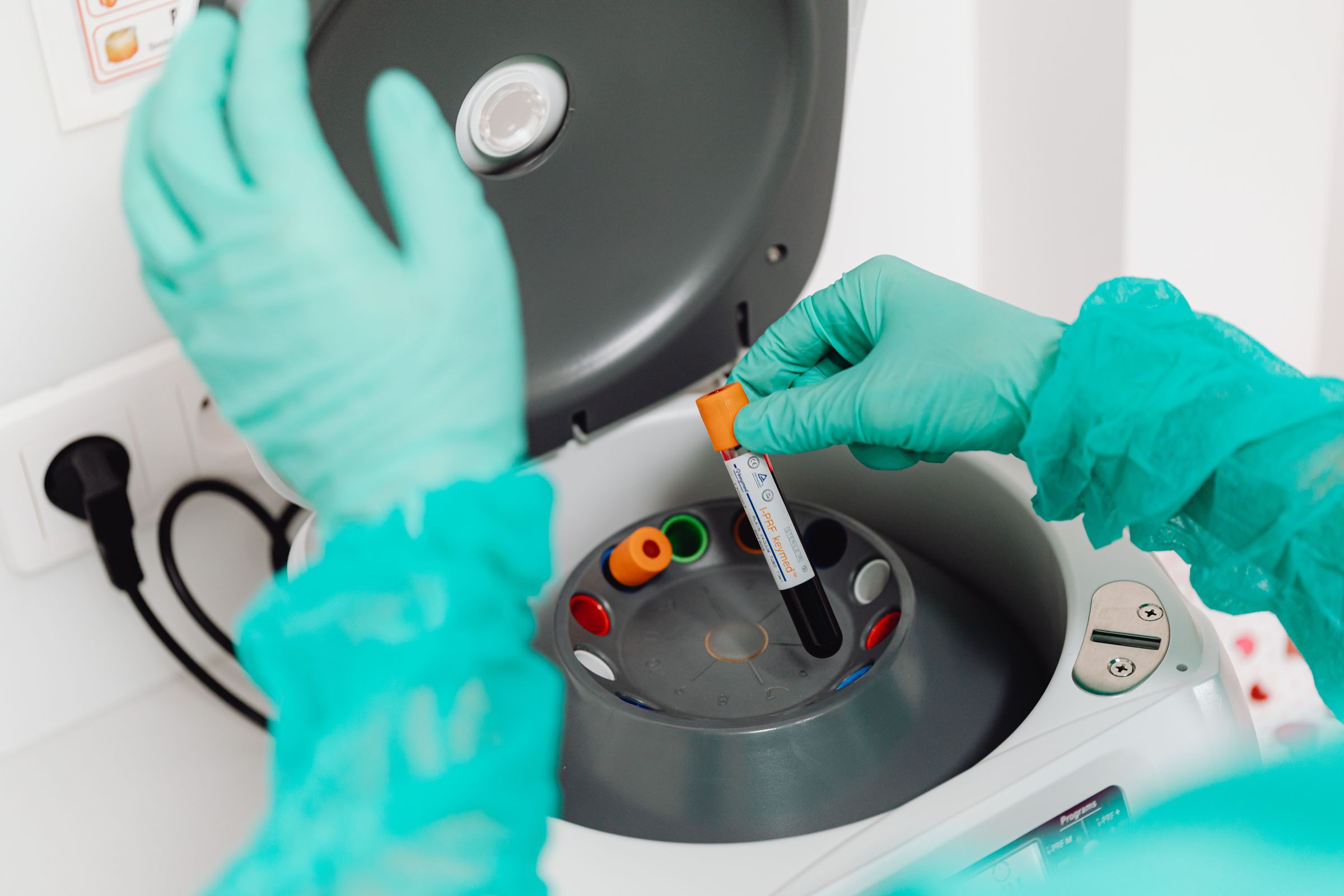 Analyse d'un échantillon sanguin en laboratoire